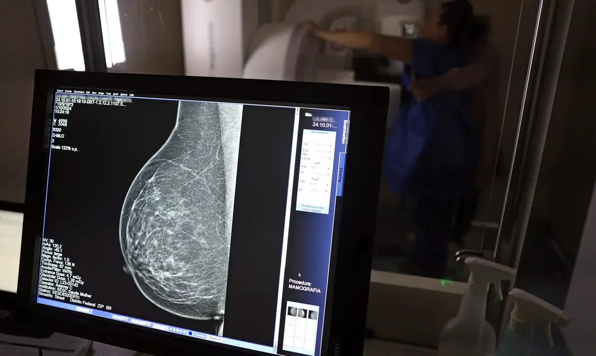 Plano de saúde terá que cobrir mamografia digital para todas as idades